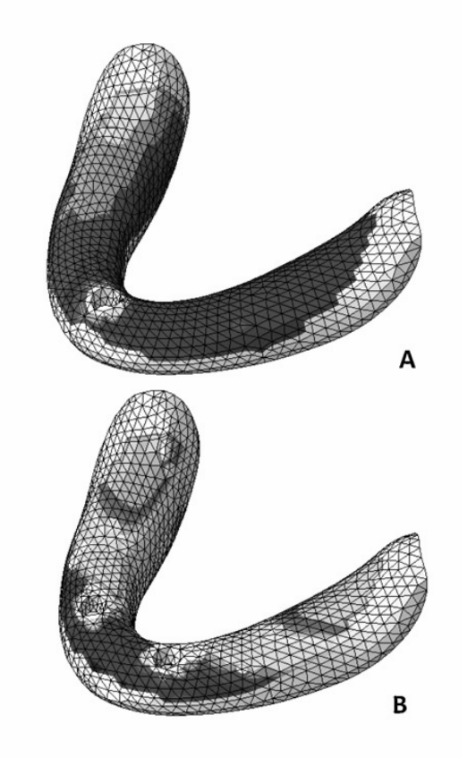mucosal area