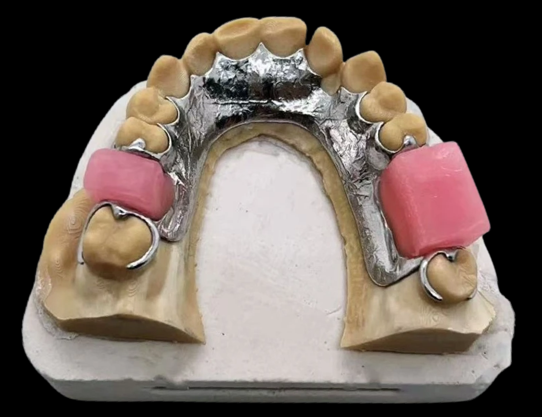 Unstable rim Major VDO change Complex jaw relationship Uncertain tooth position Inadequate time / skill to make reliable record