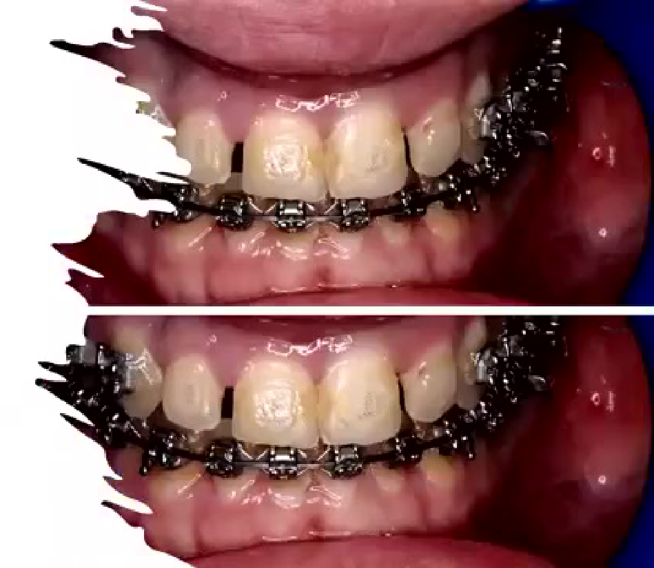 Post Ortho (2014 )