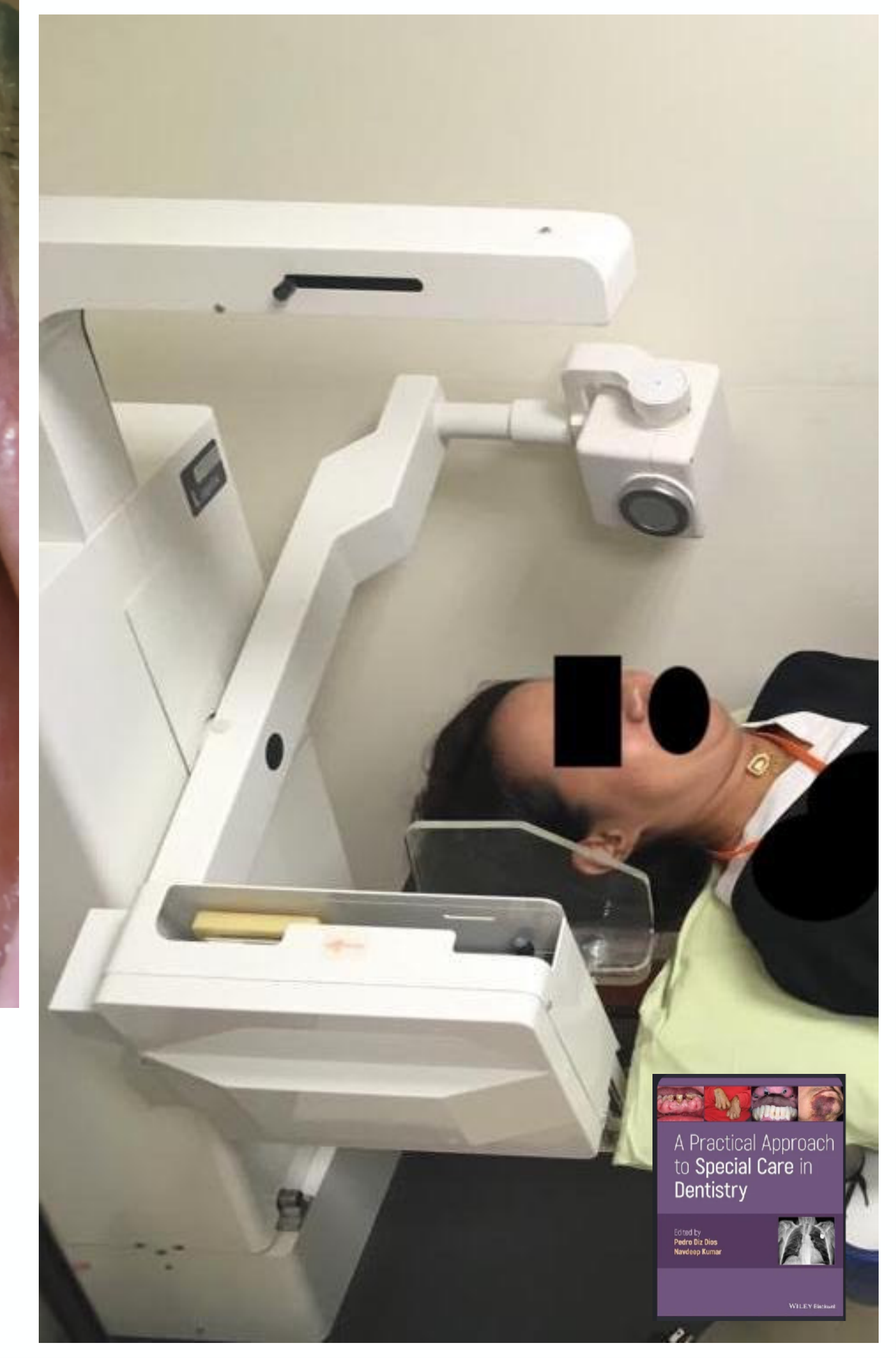 A Practical Approach to Special Care in Dentistry