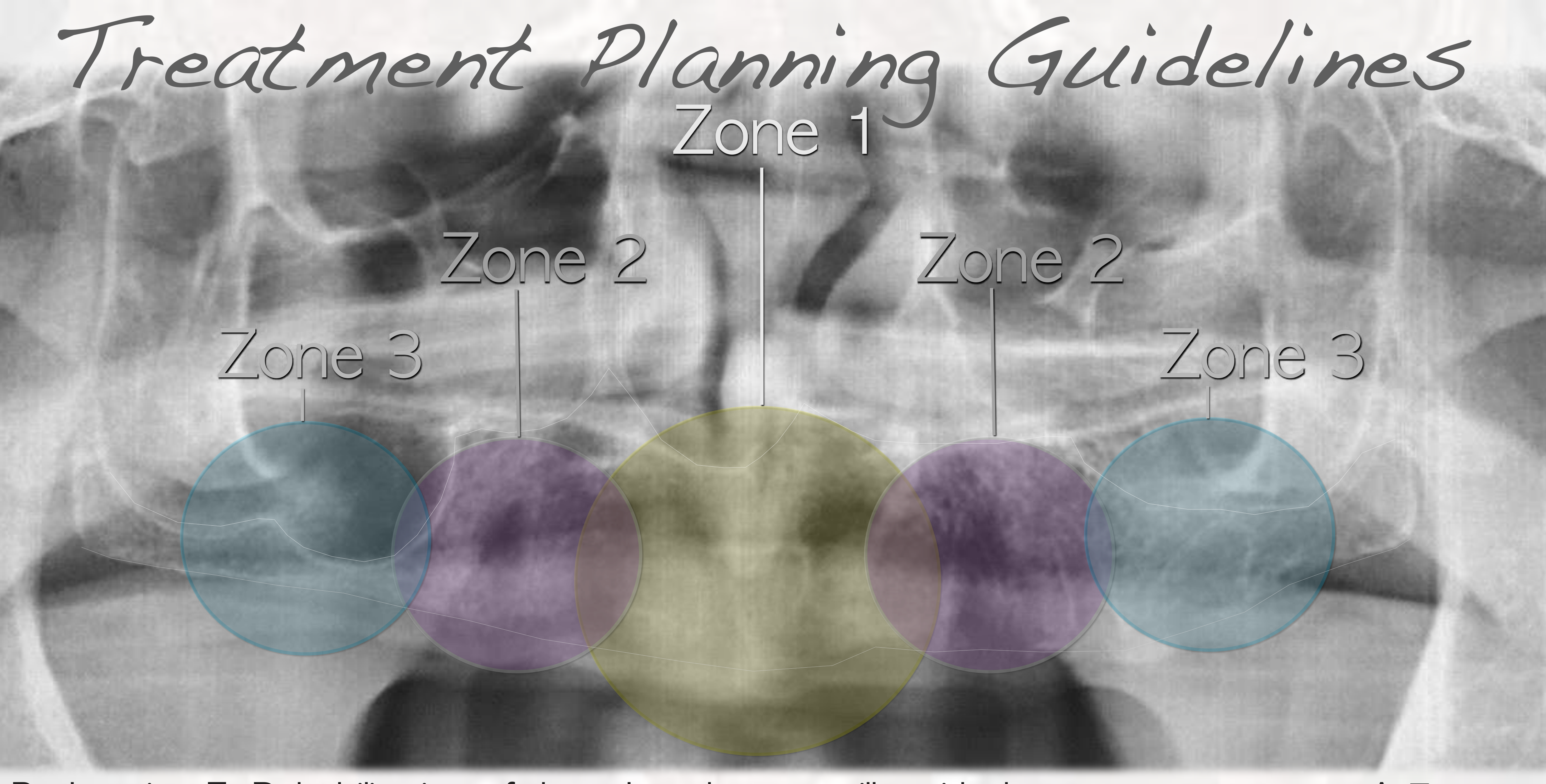 Treatment Planning Guidelines