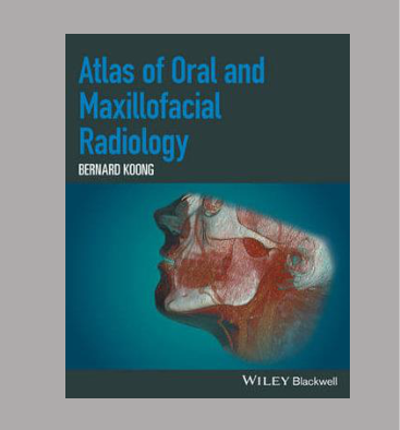 Atlas of Oral and Maxillofacial Radiology BERNARD KOENIG WILEY Blackwell