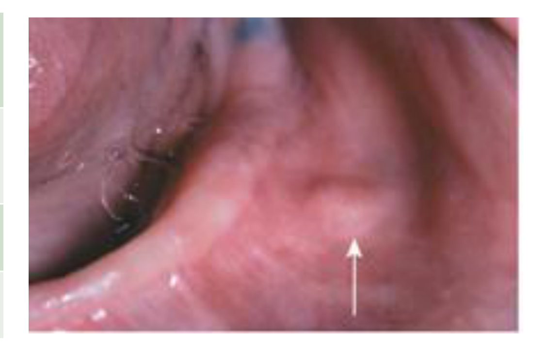 WHO,