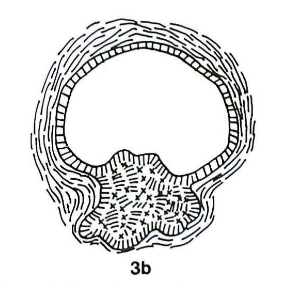 3b