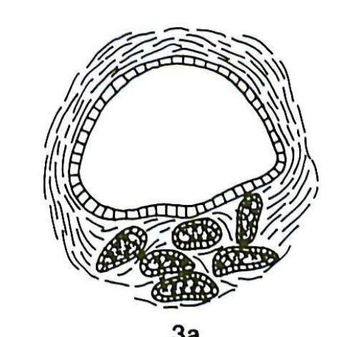 3a