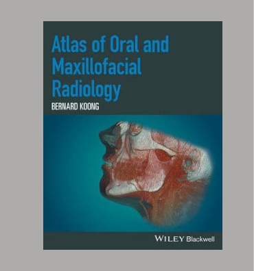 Atlas of Oral and Maxillofacial Radiology BERNARD KOOIJ WILEY Blackwell
