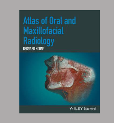 Atlas of Oral and Maxillofacial Radiology BERNARD KOZOW WILEY Blackwell