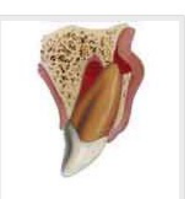 Lateral luxation