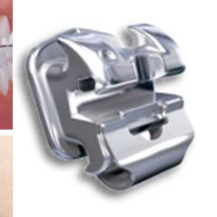 Self-Ligating Stainless Steel combination Ceramic Stainless Steel