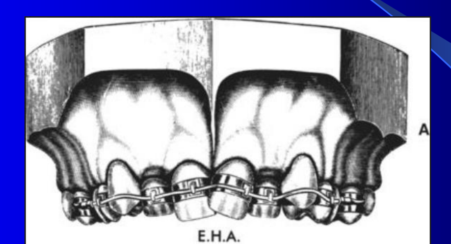 E.H.A.