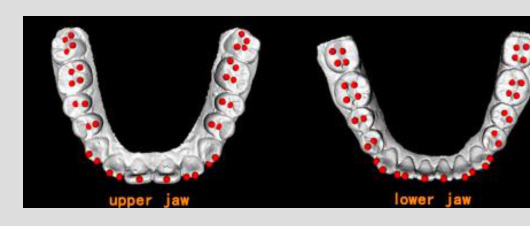 upper jaw lower jaw