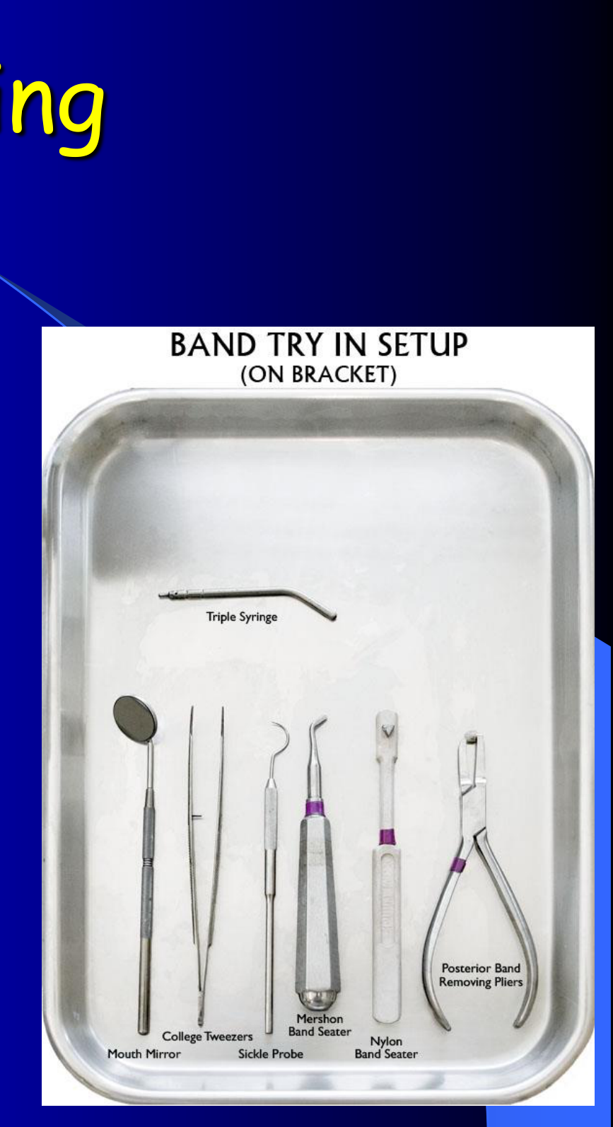 BAND TRY IN SETUP (ON BRACKET)