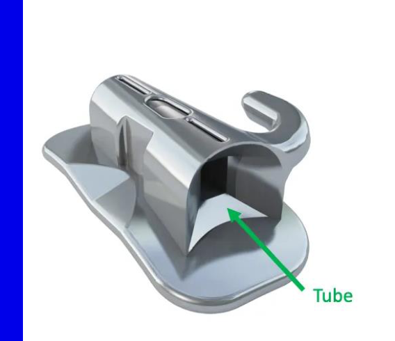 Tube