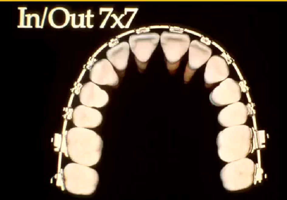In/Out