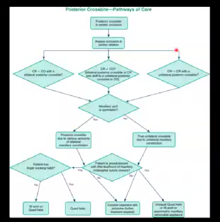 Posterior Crossbite—Pathways of Care