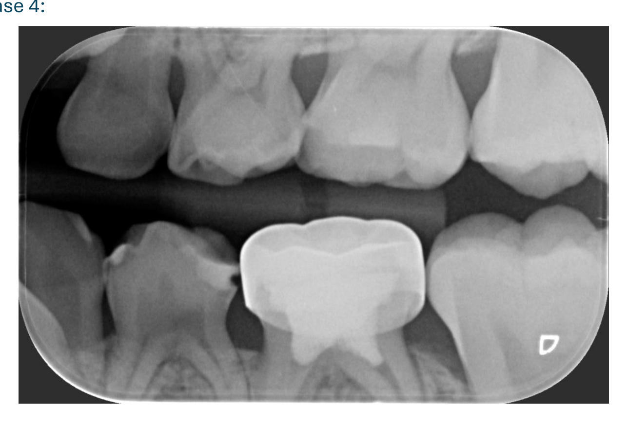 Case 4: