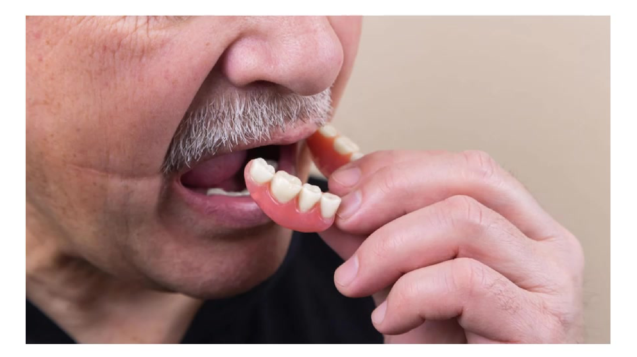 Man putting dentures in mouth