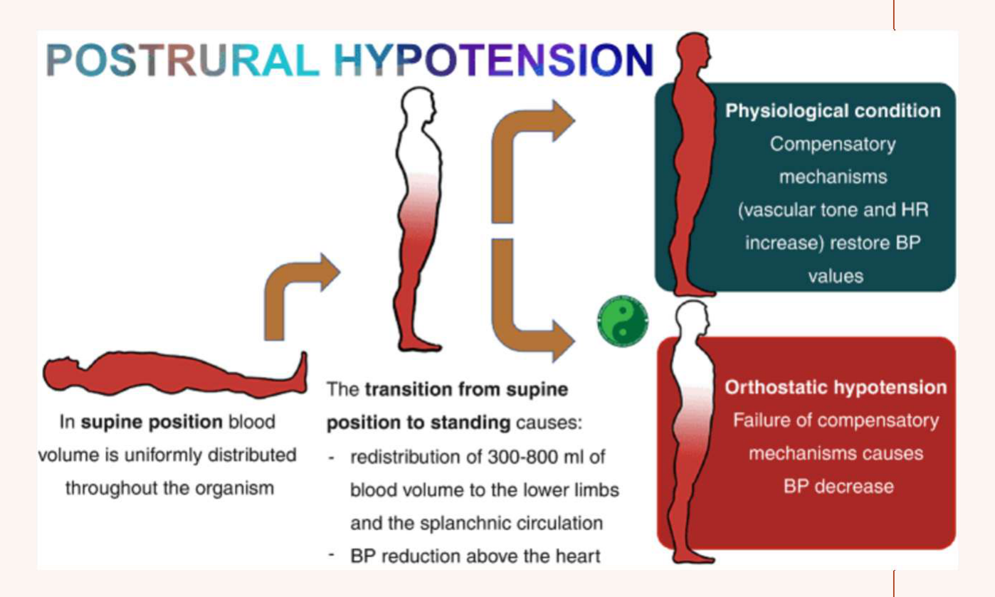 The transition from supine position to standing causes: redistribution of 300-800 ml of blood volume to the lower limbs and the splanchnic circulation