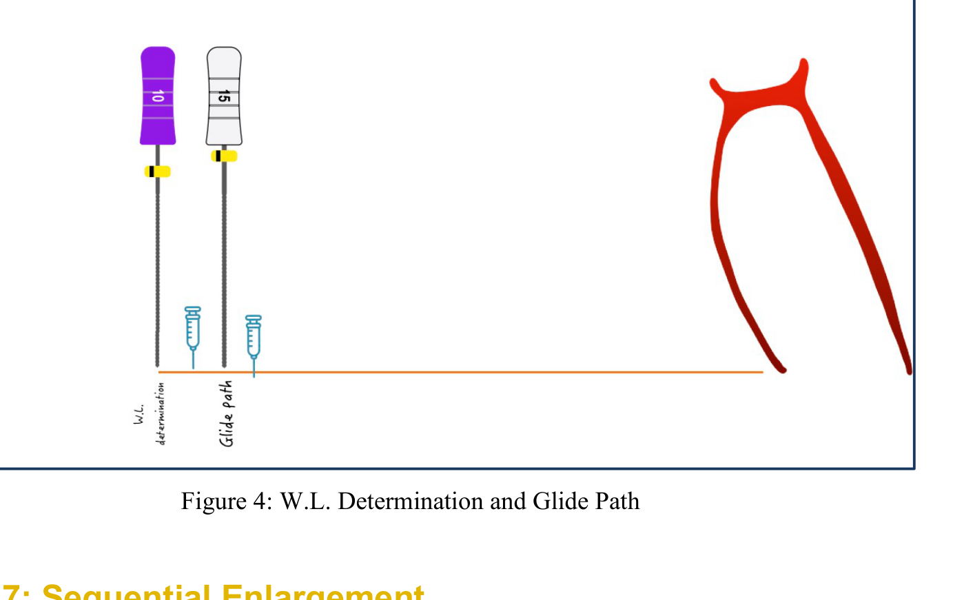 Figure 4: W.L. Determination and Glide Path