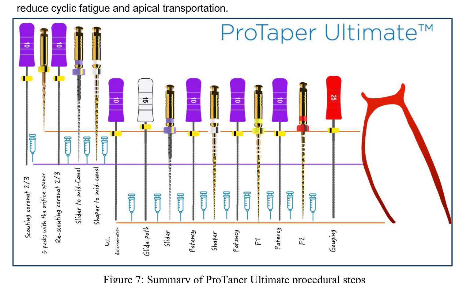 Figure 7: Summary of ProTaper Ultimate procedural steps